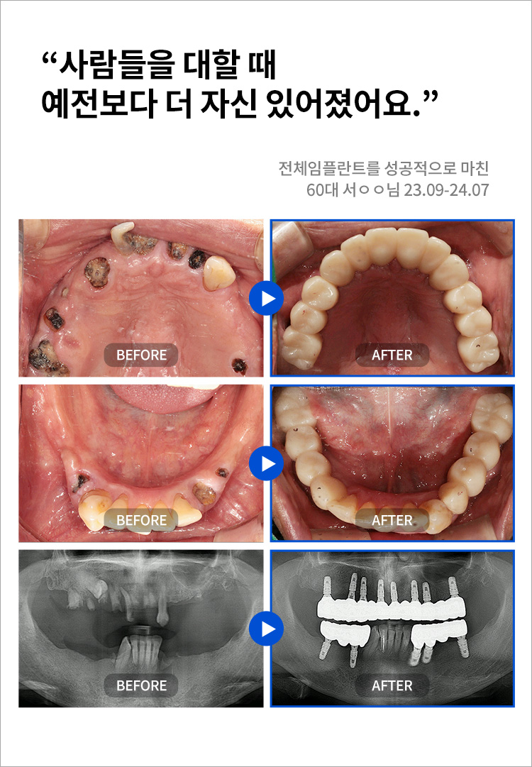 수원치과, 수원임플란트, 수원교정치과, 수원전체임플란트, 수원치아교정, 수원충치치료, 수원보철치료, 수원턱관절, 수원사랑니, 수원화이트드림치과