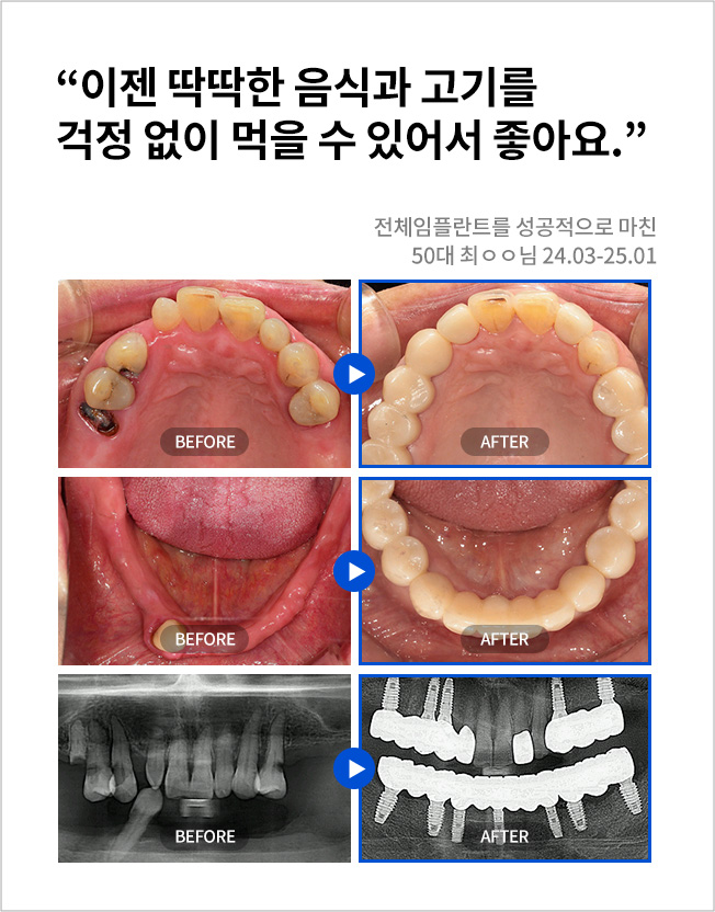 수원치과, 수원임플란트, 수원교정치과, 수원전체임플란트, 수원치아교정, 수원충치치료, 수원보철치료, 수원턱관절, 수원사랑니, 수원화이트드림치과